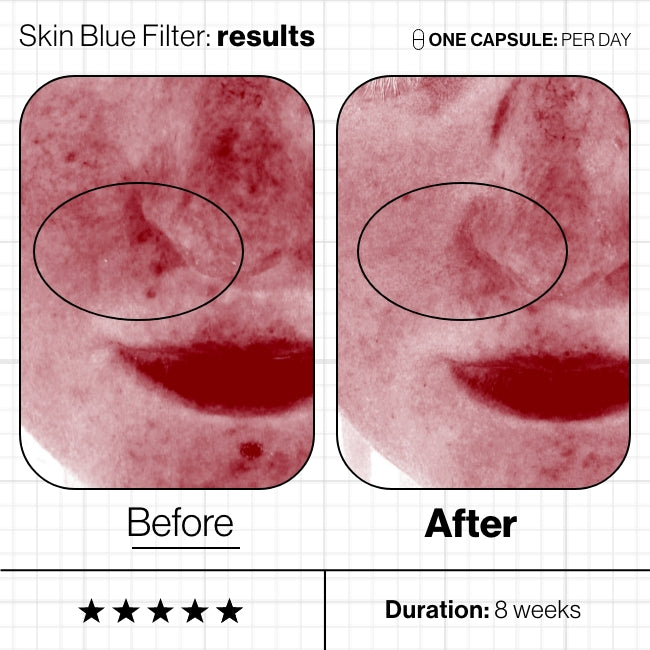 Skin Blue Filter
